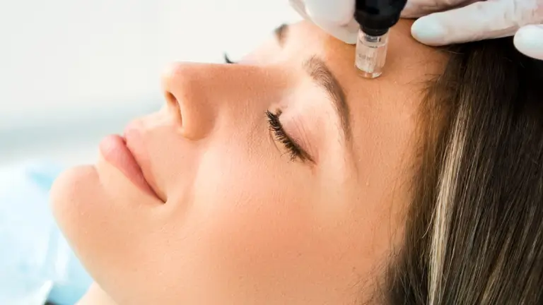 Dermapen | Centro Médico FaceSalud Dermapen | Centro Médico FaceSalud